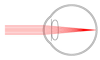 Diagram of normal eye focusing light